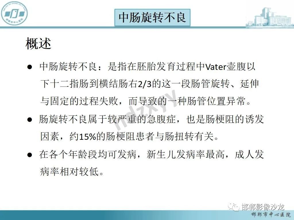 影像PPT - 【PPT】中肠旋转不良-12