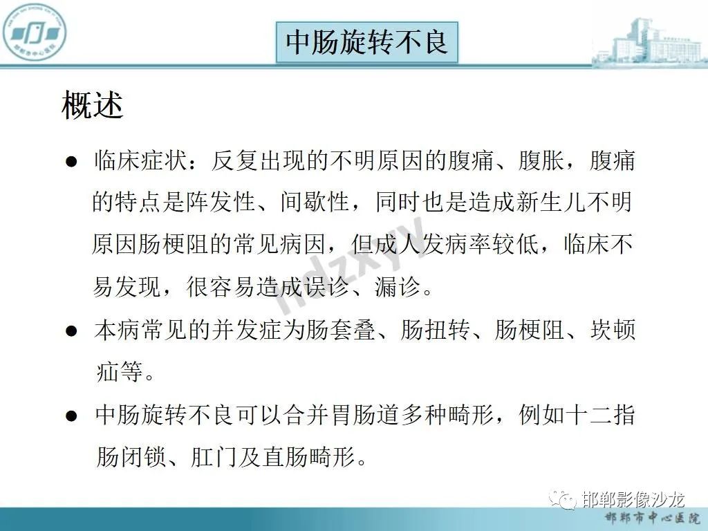 影像PPT - 【PPT】中肠旋转不良-13