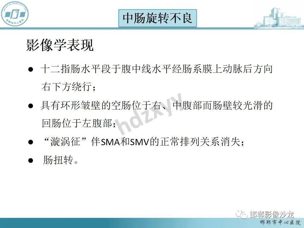 影像PPT - 【PPT】中肠旋转不良-16