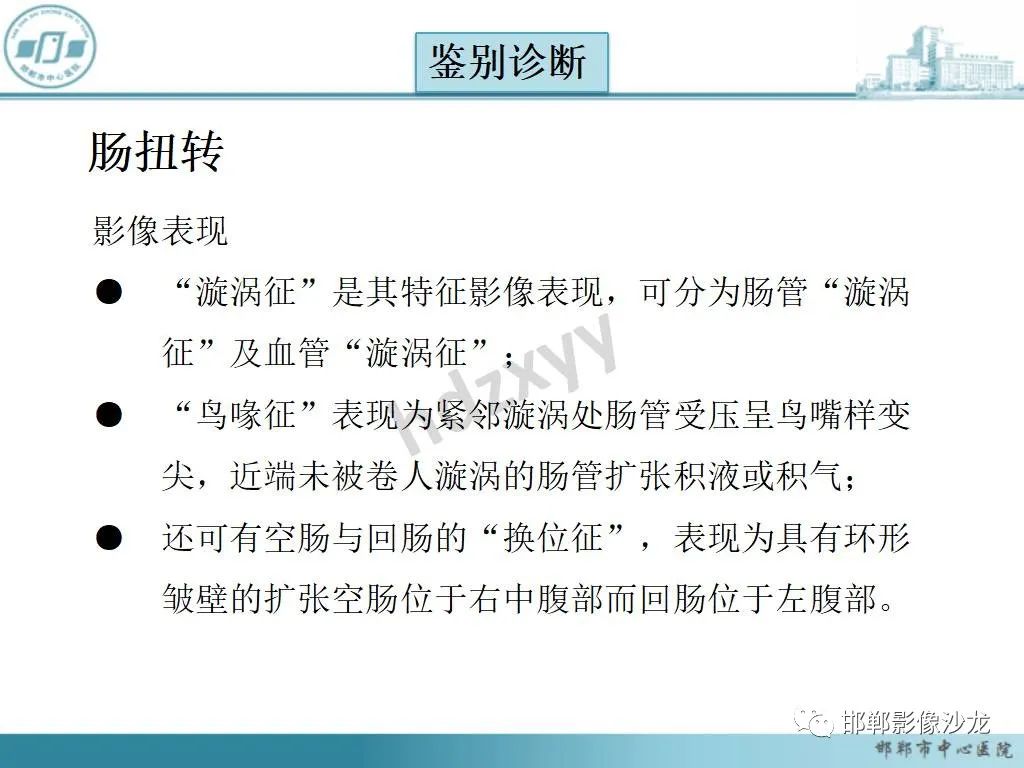 影像PPT - 【PPT】中肠旋转不良-21