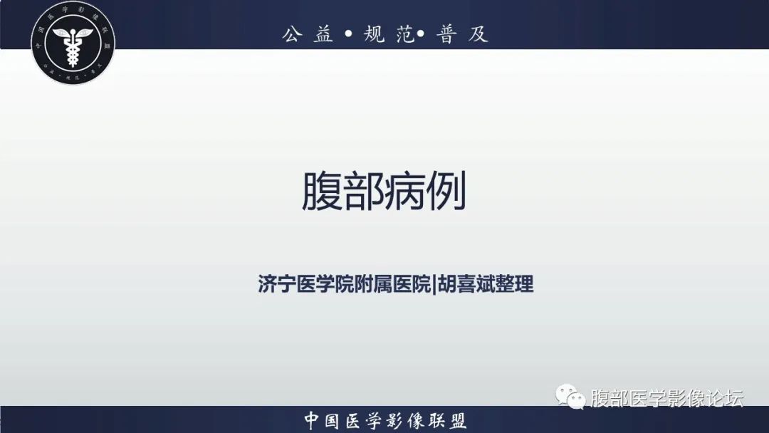 影像PPT - 【病例】脾脏窦岸细胞血管瘤1例MR影像诊断-2