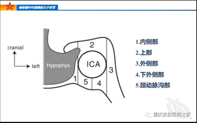 影像PPT - 【PPT】垂体瘤MRI诊断的几个环节-34