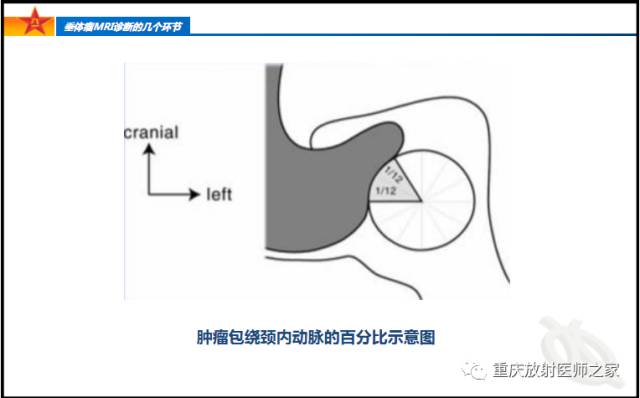 影像PPT - 【PPT】垂体瘤MRI诊断的几个环节-36