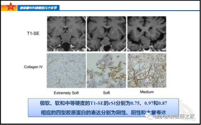 影像PPT - 【PPT】垂体瘤MRI诊断的几个环节-45