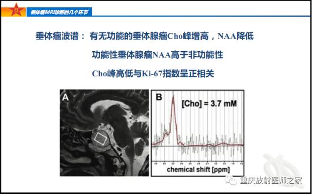 影像PPT - 【PPT】垂体瘤MRI诊断的几个环节-78