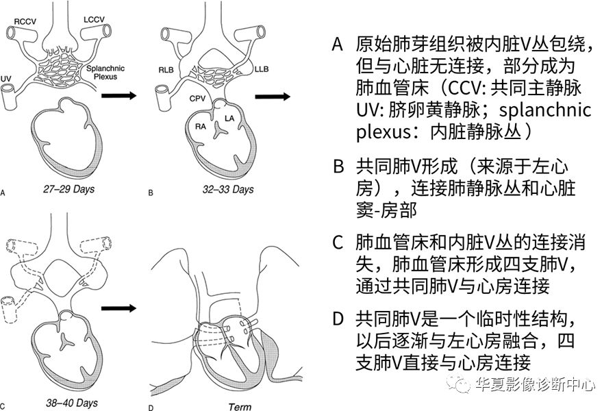 影像PPT - 弯刀综合征-9