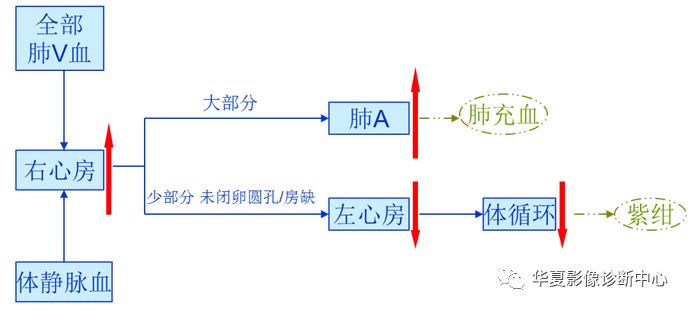 影像PPT - 弯刀综合征-11