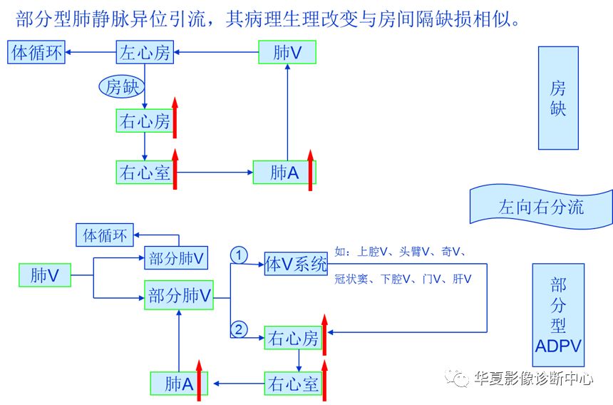 影像PPT - 弯刀综合征-12