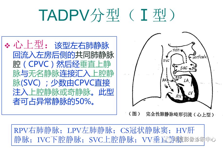 影像PPT - 弯刀综合征-26