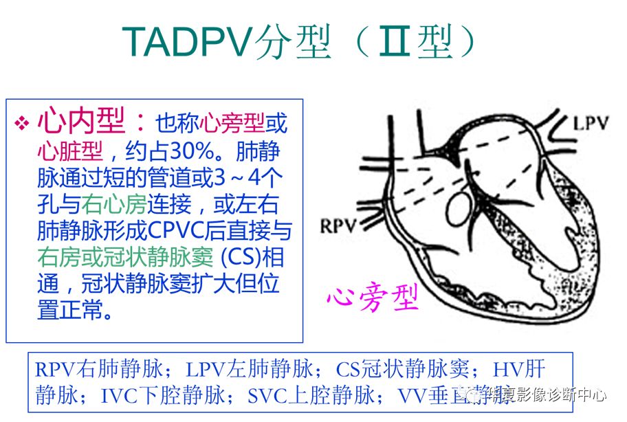 影像PPT - 弯刀综合征-33