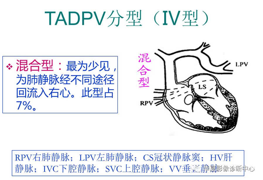 影像PPT - 弯刀综合征-40