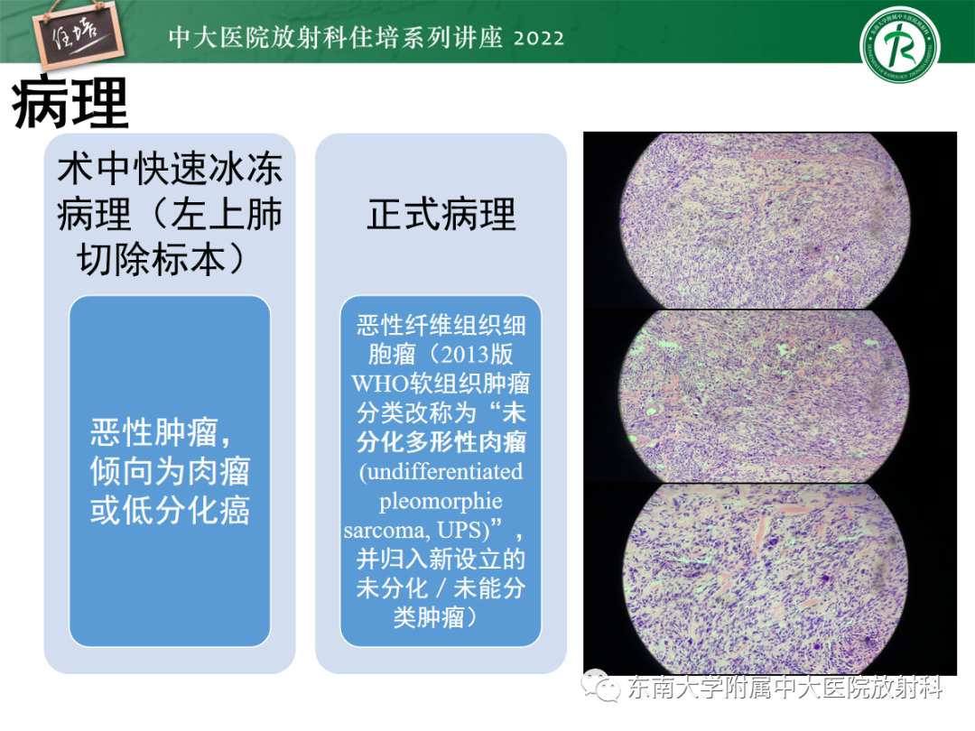 影像PPT - 【PPT】肺空腔、空洞性病变诊断分析思路-54