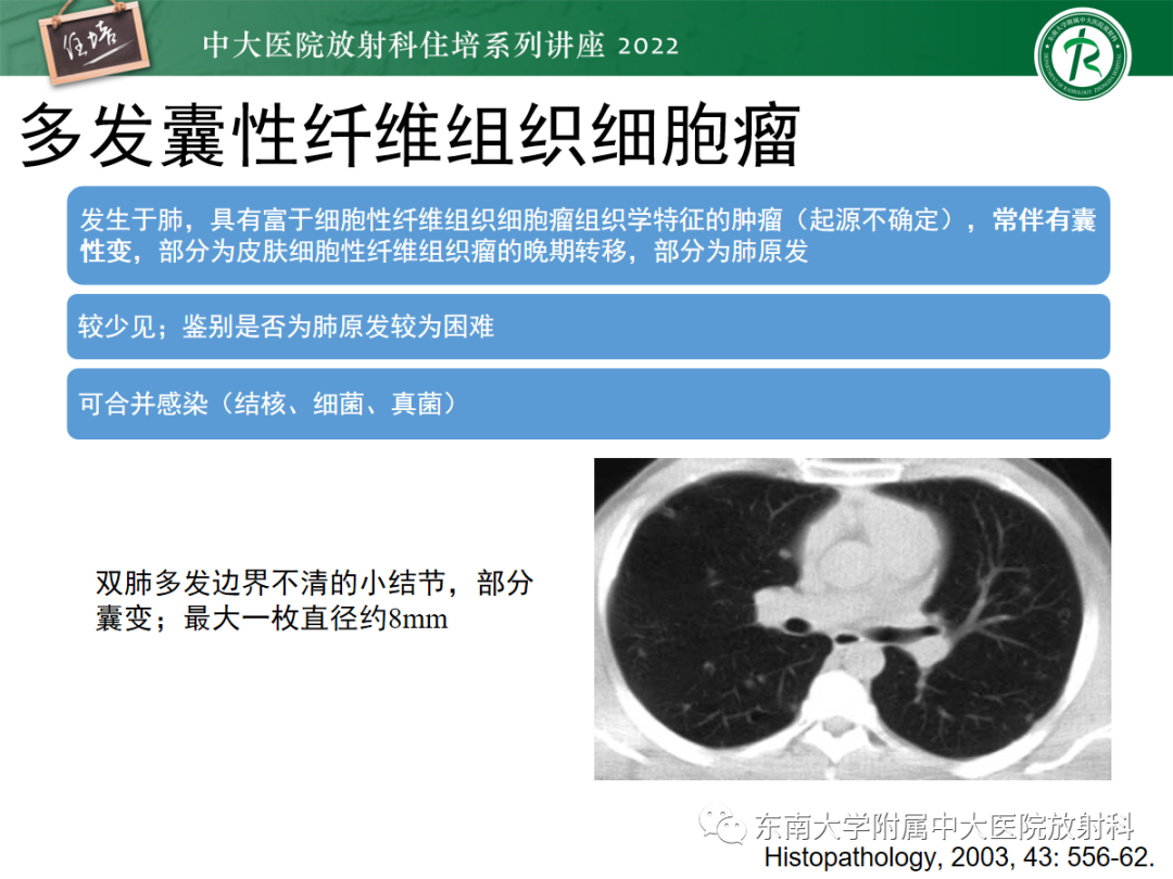影像PPT - 【PPT】肺空腔、空洞性病变诊断分析思路-62