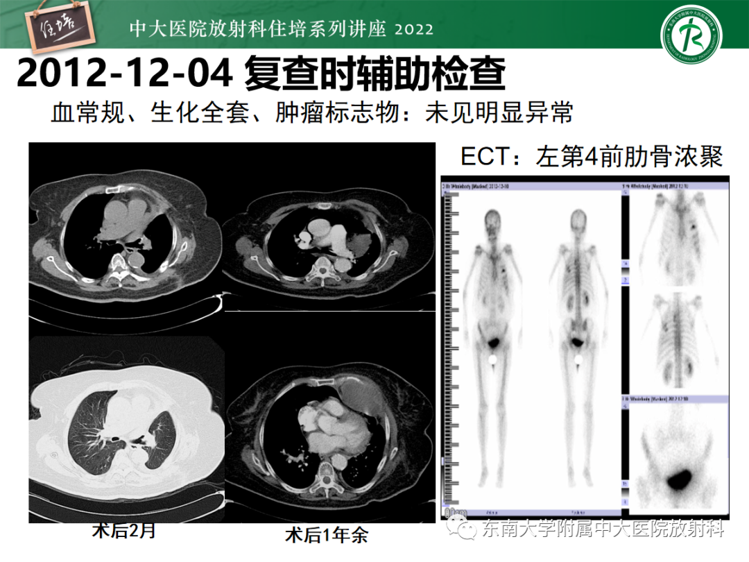 影像PPT - 【PPT】肺空腔、空洞性病变诊断分析思路-2