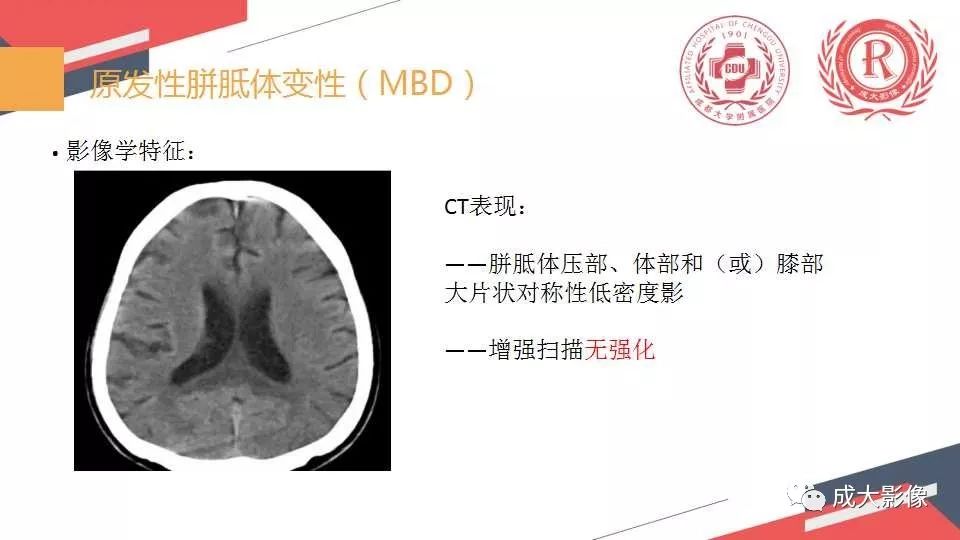 影像PPT - 【PPT】胼胝体病变MRI诊断-7