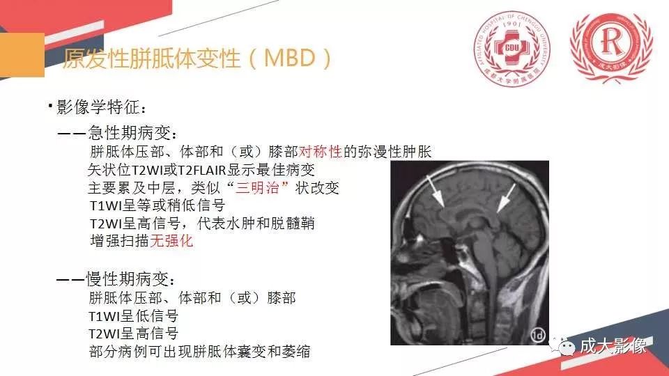 影像PPT - 【PPT】胼胝体病变MRI诊断-8