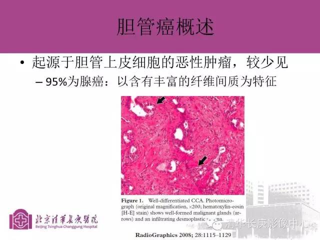 影像PPT - 【病例】胆管高分化腺癌1例CT及MR-14