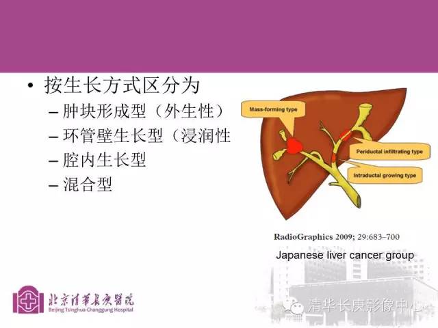 影像PPT - 【病例】胆管高分化腺癌1例CT及MR-17