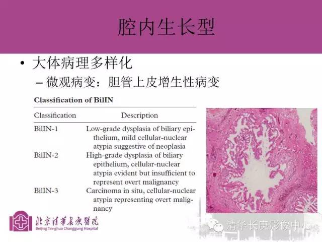 影像PPT - 【病例】胆管高分化腺癌1例CT及MR-30