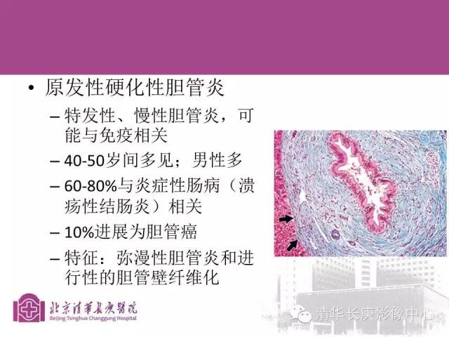 影像PPT - 【病例】胆管高分化腺癌1例CT及MR-35