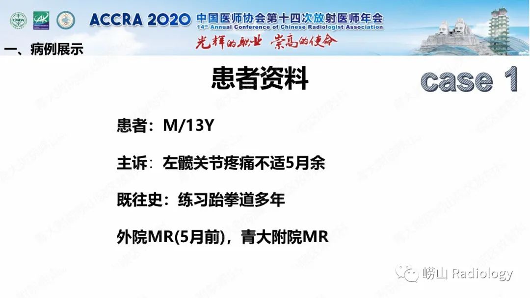 影像PPT - 【PPT】关节内骨样骨瘤的影像诊断-3