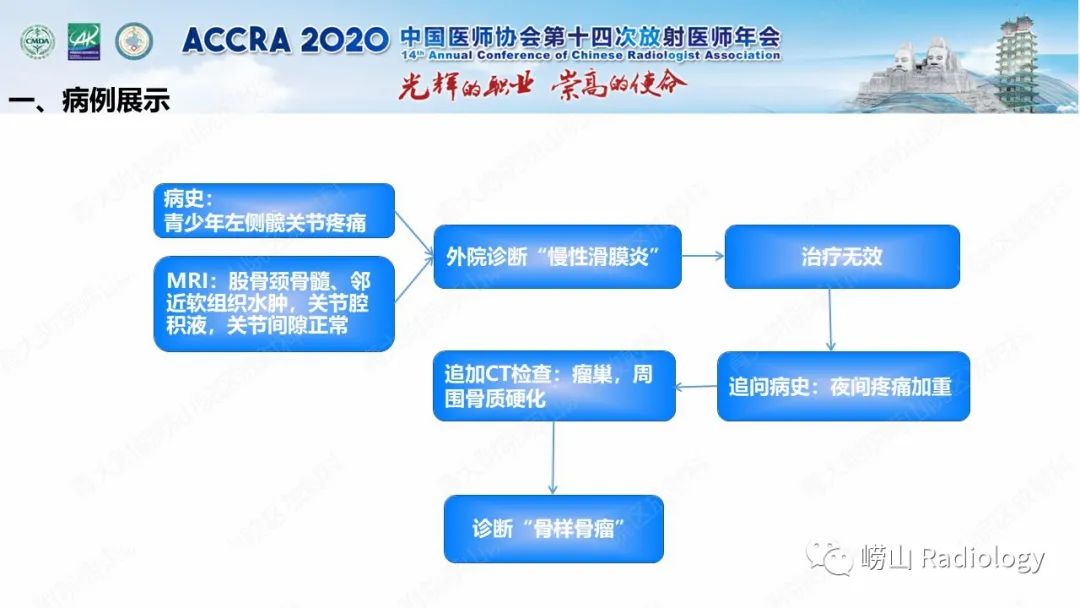 影像PPT - 【PPT】关节内骨样骨瘤的影像诊断-12