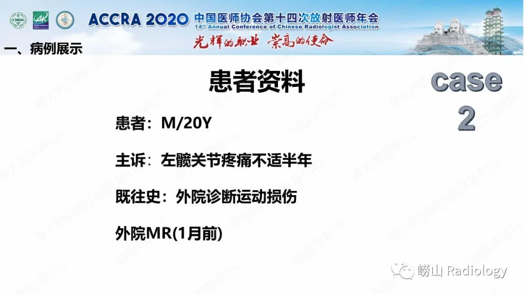 影像PPT - 【PPT】关节内骨样骨瘤的影像诊断-13