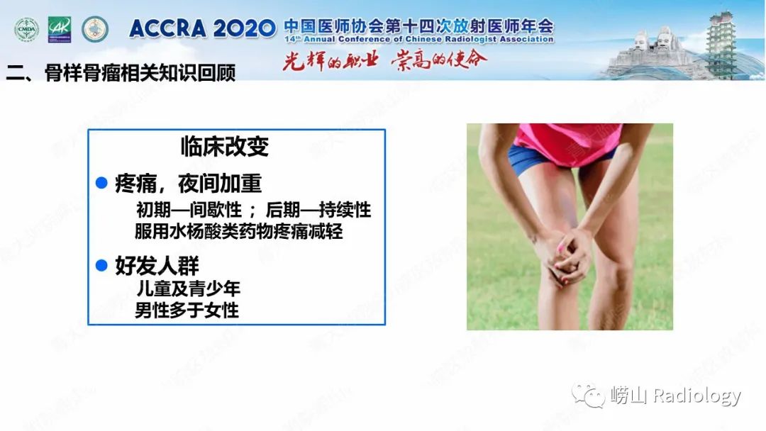 影像PPT - 【PPT】关节内骨样骨瘤的影像诊断-22