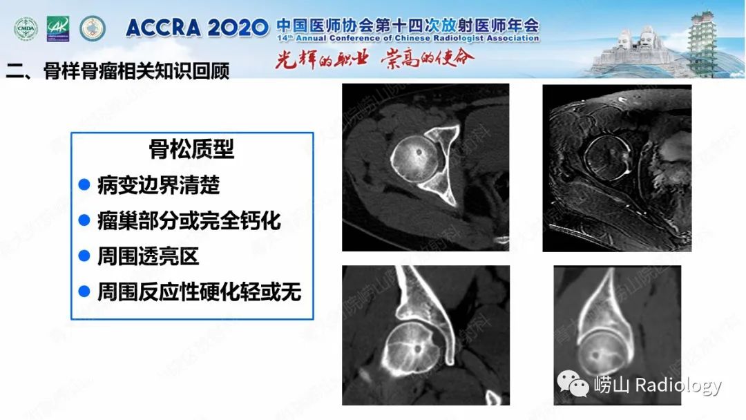 影像PPT - 【PPT】关节内骨样骨瘤的影像诊断-27