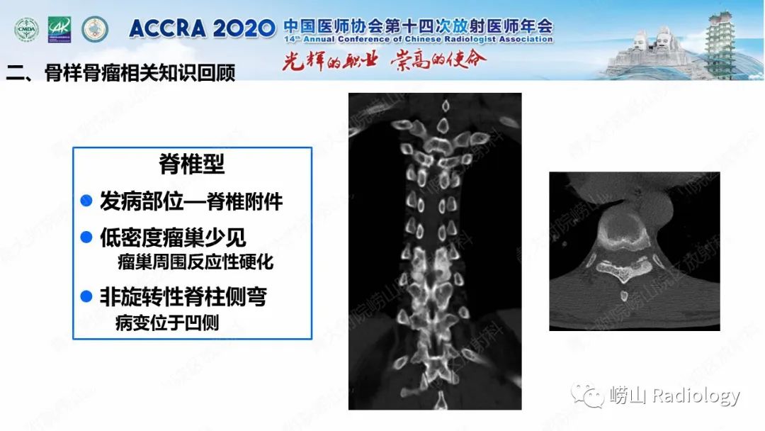 影像PPT - 【PPT】关节内骨样骨瘤的影像诊断-28