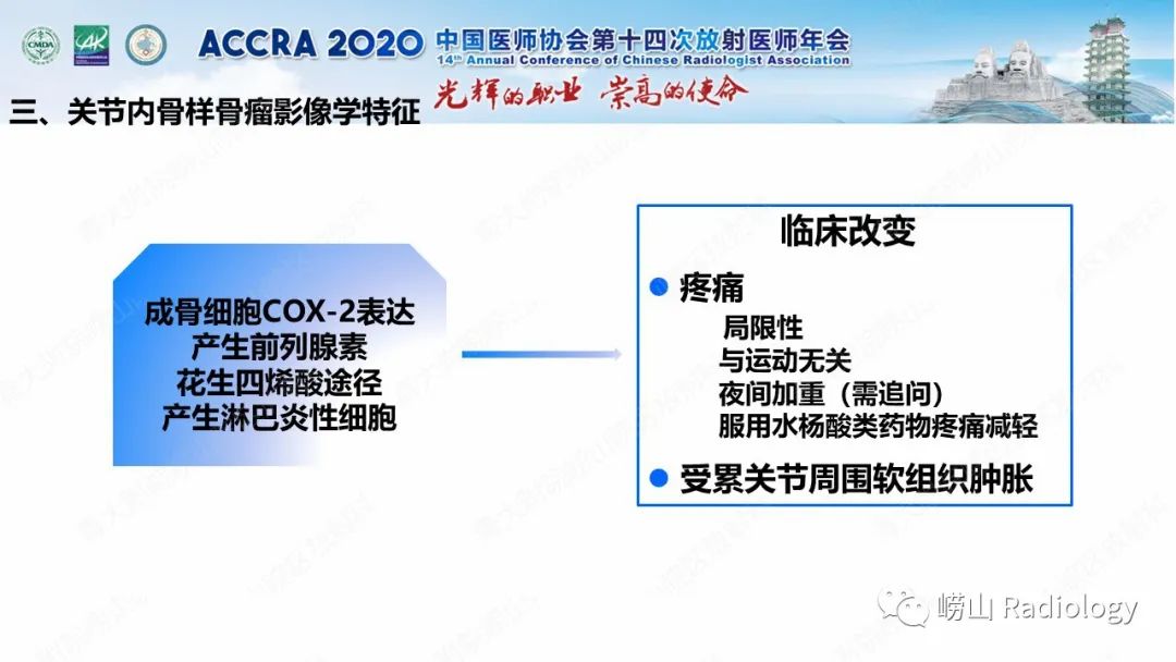 影像PPT - 【PPT】关节内骨样骨瘤的影像诊断-30