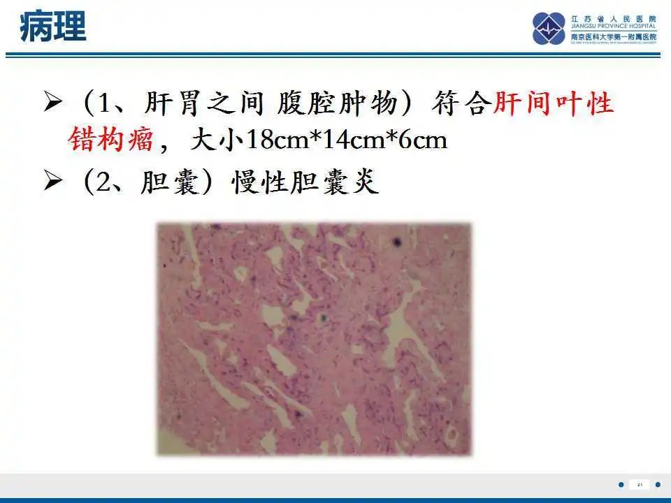影像PPT - 【PPT】肝间叶性错构瘤-22