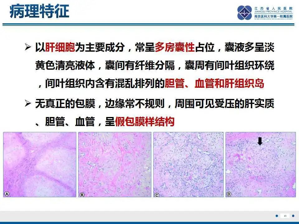 影像PPT - 【PPT】肝间叶性错构瘤-24