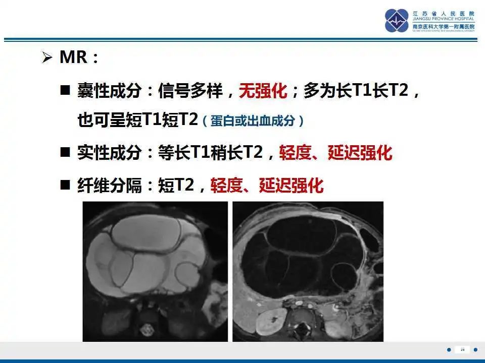 影像PPT - 【PPT】肝间叶性错构瘤-27
