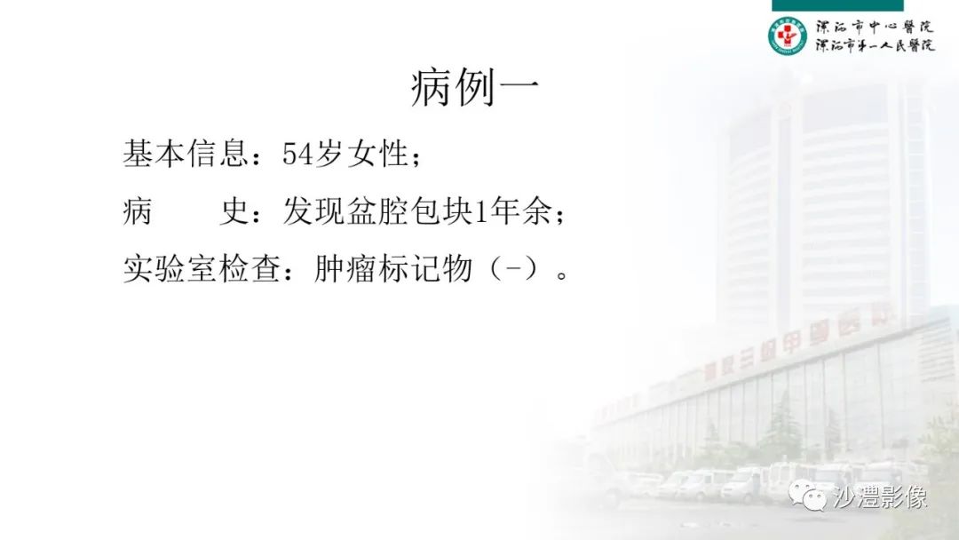 影像PPT - 【PPT】卵巢T2WI低信号病变分析-2 影像PPT - 【PPT】卵巢T2WI低信号病变分析-2