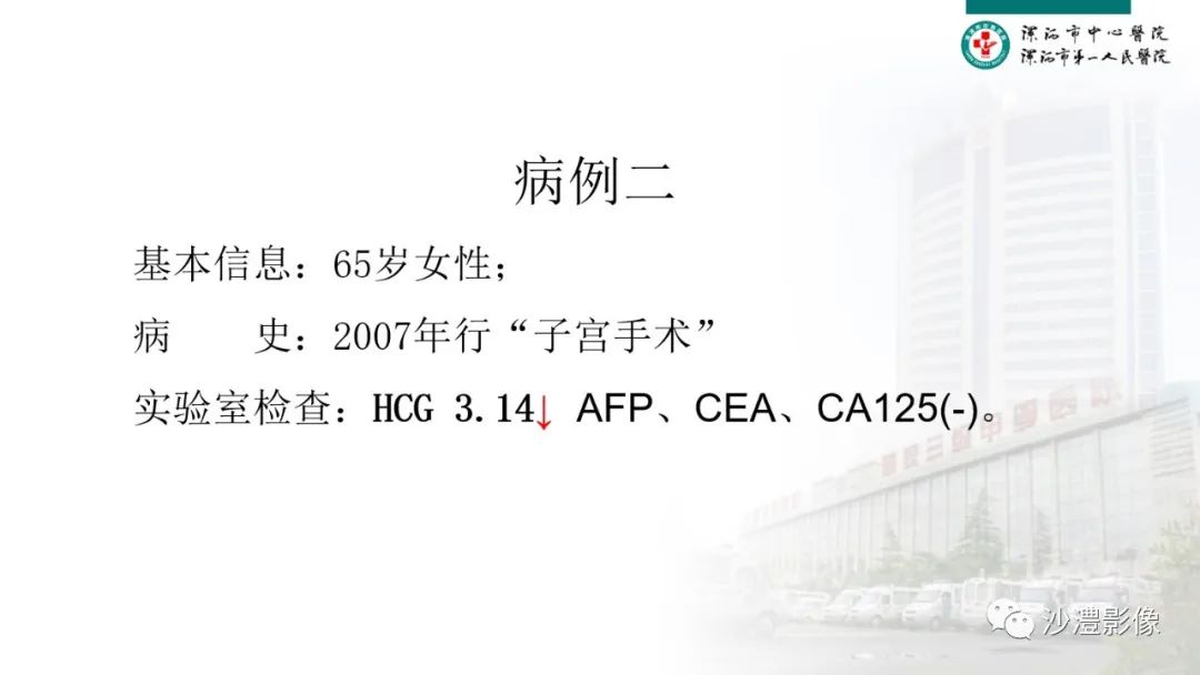 影像PPT - 【PPT】卵巢T2WI低信号病变分析-4 影像PPT - 【PPT】卵巢T2WI低信号病变分析-4