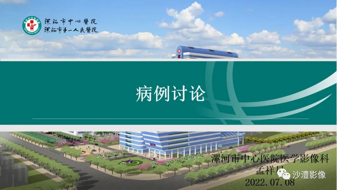 影像PPT - 【PPT】卵巢T2WI低信号病变分析-1 影像PPT - 【PPT】卵巢T2WI低信号病变分析-1