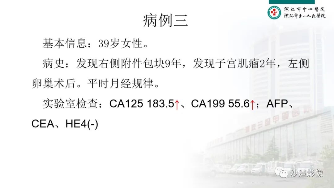影像PPT - 【PPT】卵巢T2WI低信号病变分析-7 影像PPT - 【PPT】卵巢T2WI低信号病变分析-7