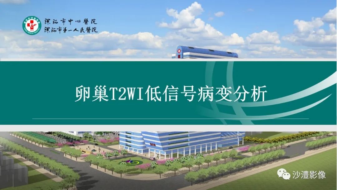 影像PPT - 【PPT】卵巢T2WI低信号病变分析-12 影像PPT - 【PPT】卵巢T2WI低信号病变分析-12