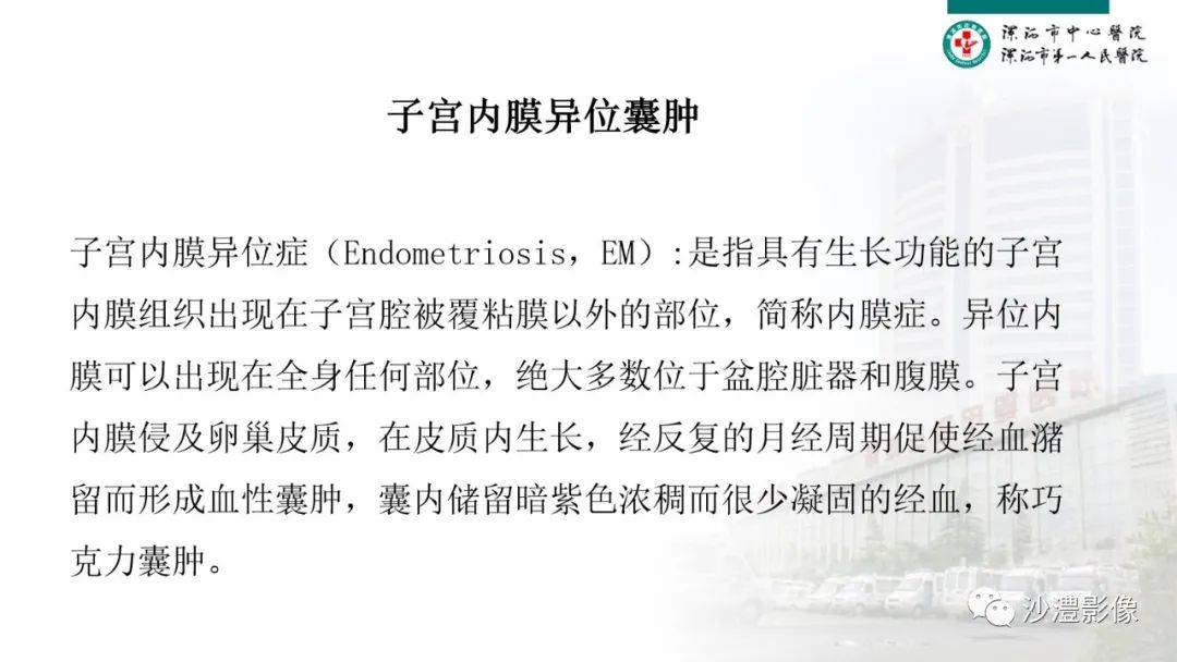影像PPT - 【PPT】卵巢T2WI低信号病变分析-15 影像PPT - 【PPT】卵巢T2WI低信号病变分析-15