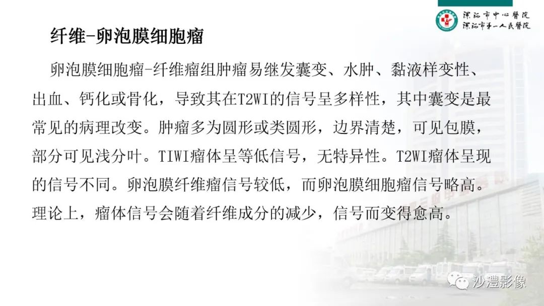 影像PPT - 【PPT】卵巢T2WI低信号病变分析-31 影像PPT - 【PPT】卵巢T2WI低信号病变分析-31