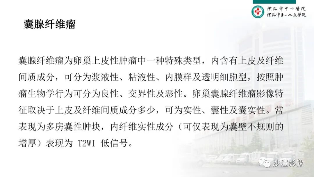影像PPT - 【PPT】卵巢T2WI低信号病变分析-34 影像PPT - 【PPT】卵巢T2WI低信号病变分析-34