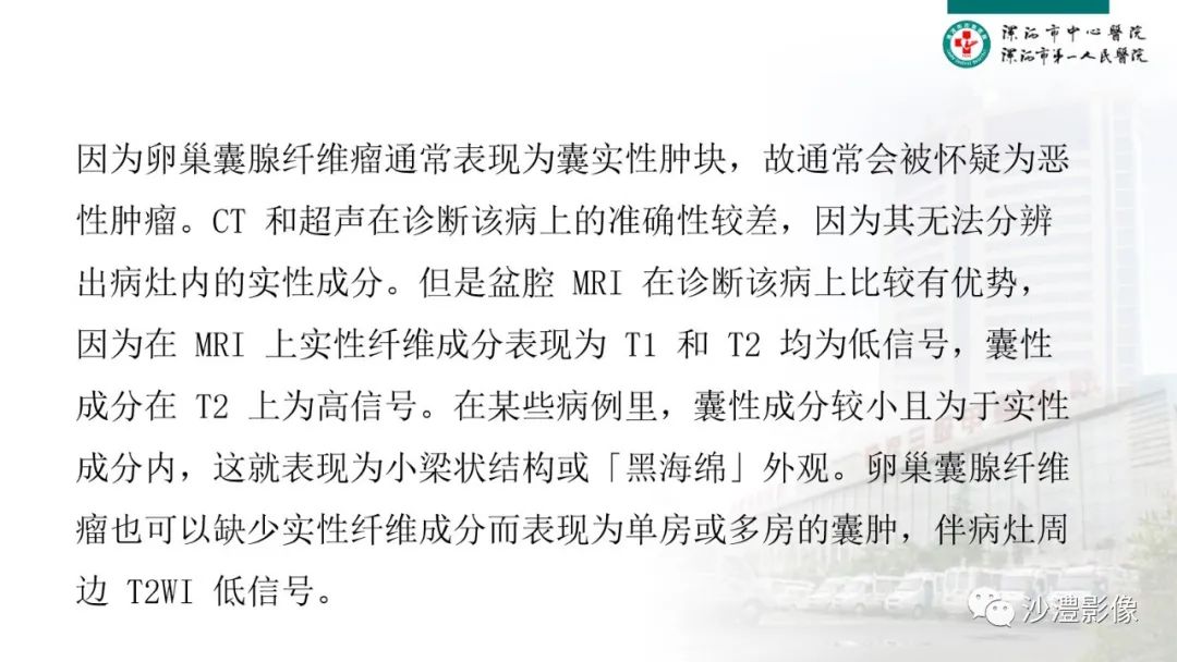 影像PPT - 【PPT】卵巢T2WI低信号病变分析-35 影像PPT - 【PPT】卵巢T2WI低信号病变分析-35