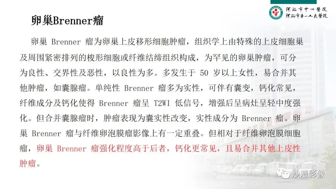 影像PPT - 【PPT】卵巢T2WI低信号病变分析-44 影像PPT - 【PPT】卵巢T2WI低信号病变分析-44