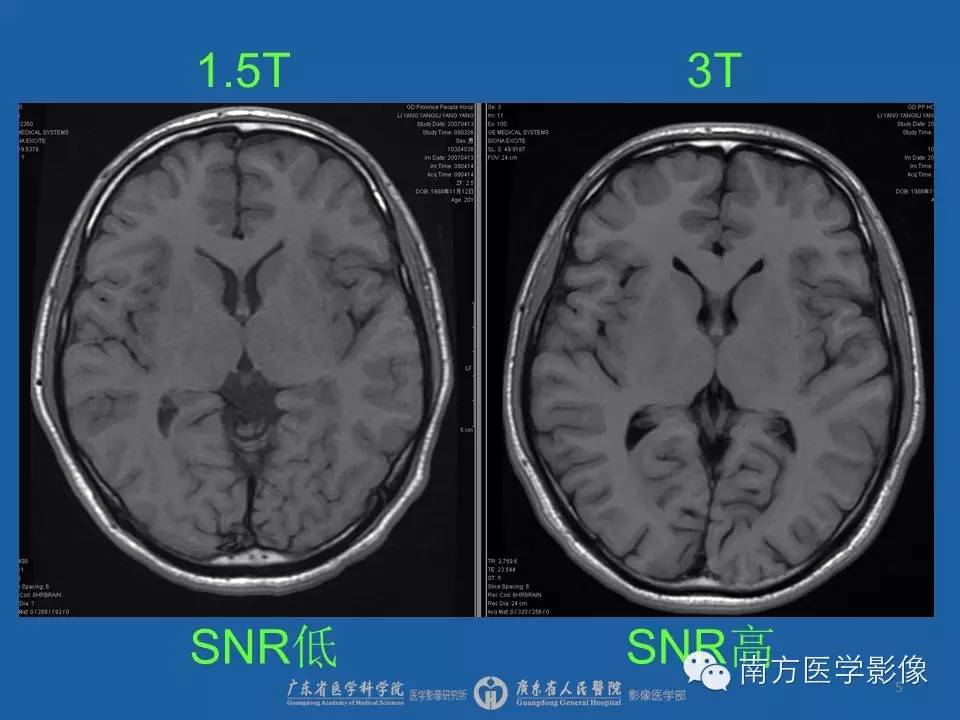 影像PPT - 【PPT】磁共振图像的信噪比-5