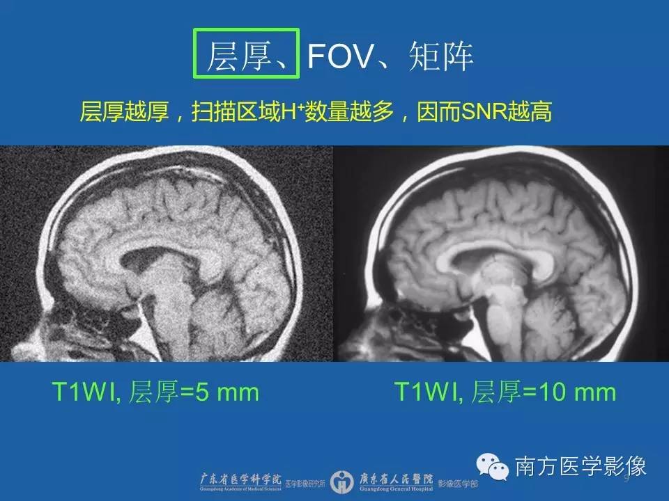 影像PPT - 【PPT】磁共振图像的信噪比-9
