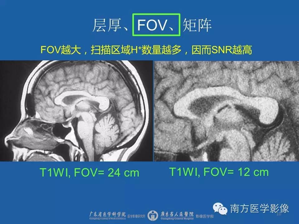 影像PPT - 【PPT】磁共振图像的信噪比-10