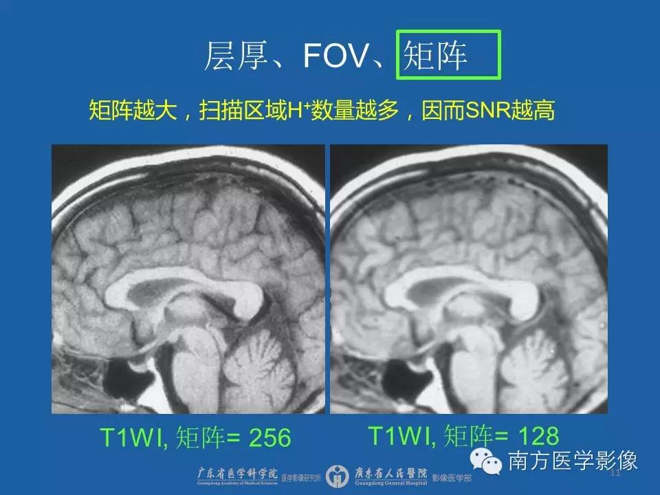 影像PPT - 【PPT】磁共振图像的信噪比-11