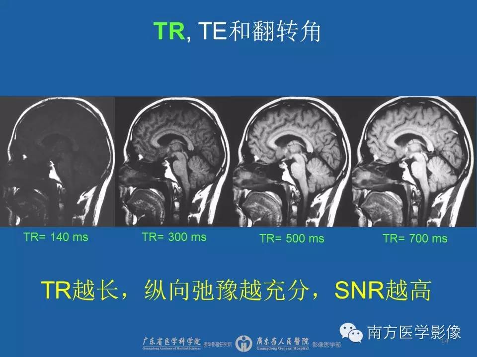 影像PPT - 【PPT】磁共振图像的信噪比-14