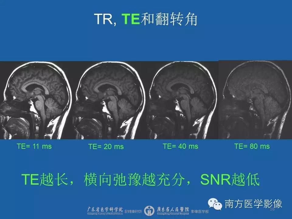 影像PPT - 【PPT】磁共振图像的信噪比-16